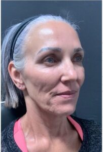 Before Image: Ellacor